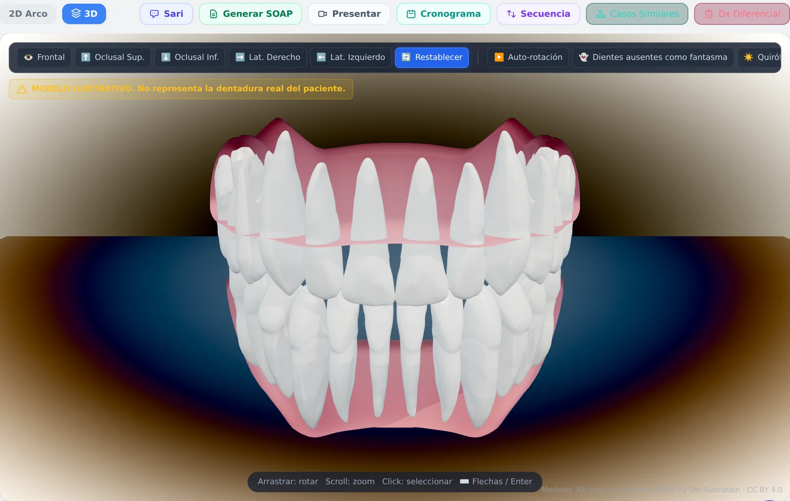 El odontograma 3D de Sarident dentro de la historia clínica, sobre un paciente ficticio: vistas frontal, oclusales y laterales, y cada diente se selecciona con un clic.